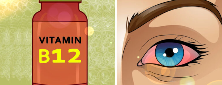 How Long To Recover From Vitamin B12 Deficiency